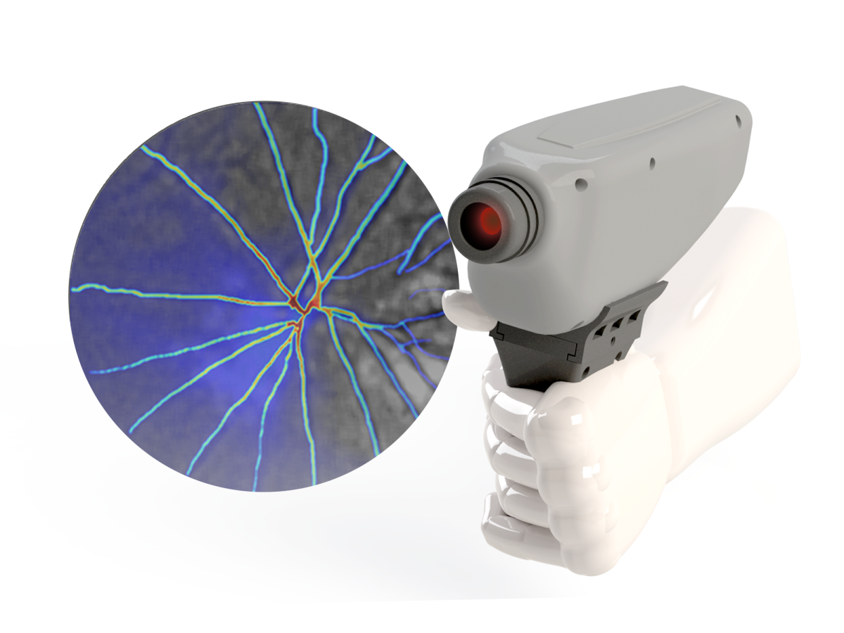 A mock-up of Vasoptic's device and pre-clinical imaging.