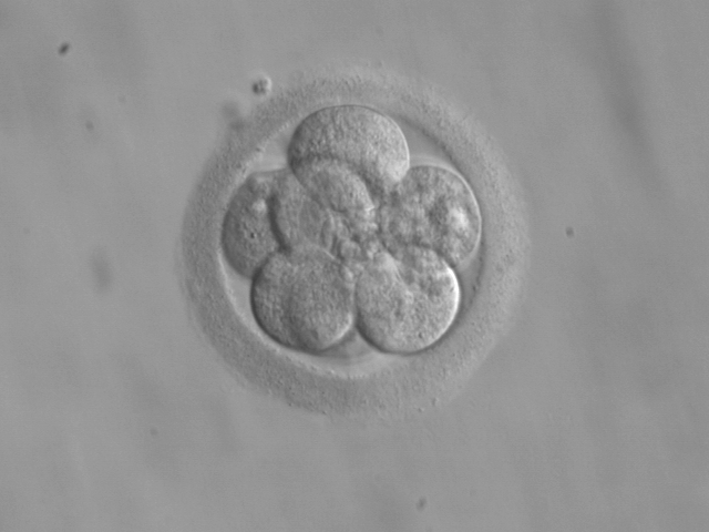  This is an 8-cell embryo at three days. (Photo from the RWJMS IVF Program, via Wikimedia Commons)