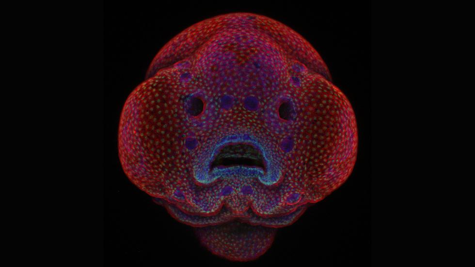 Small World 2016 winning photograph of a zebrafish fetus.
